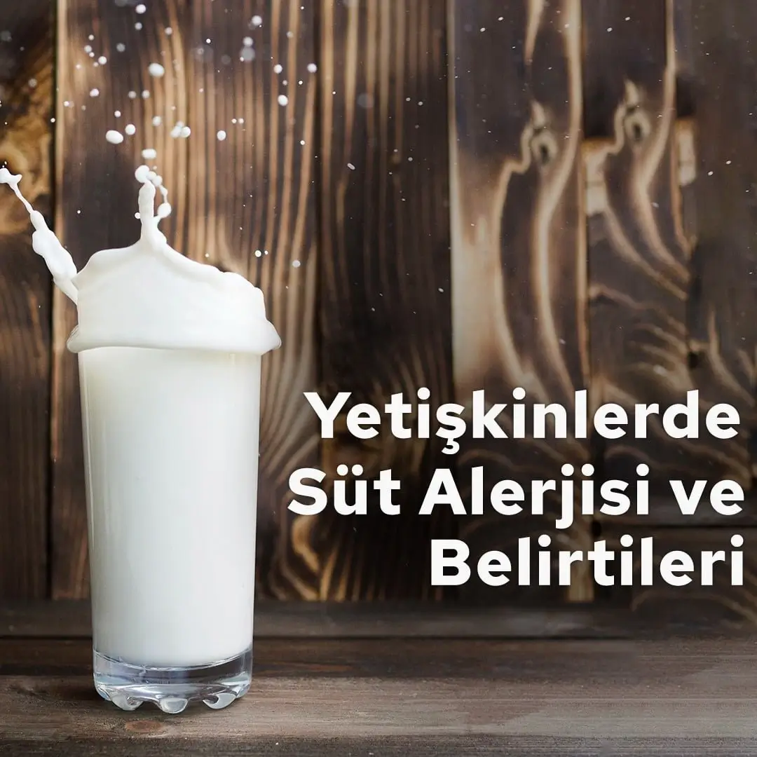 Yetişkinlerde Süt Alerjisi ve Belirtileri